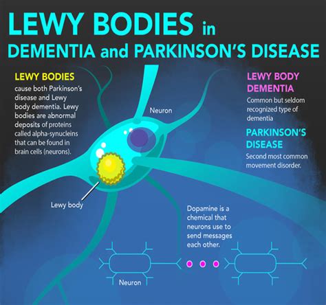 Lewy body disease and dementia with Lewy bodies .